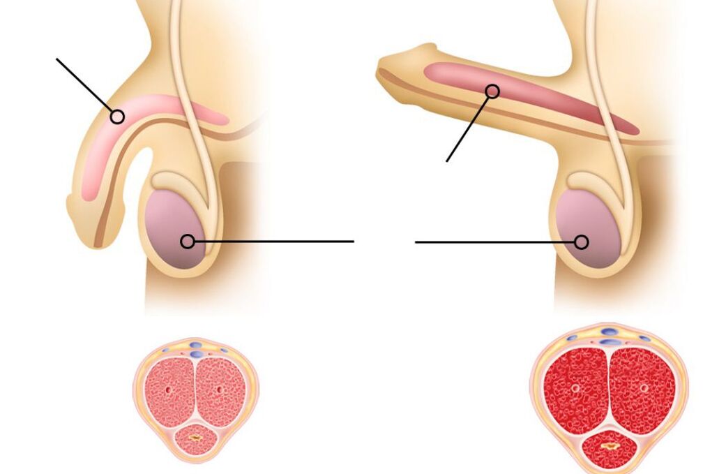 Reasons for the decrease in potency in men